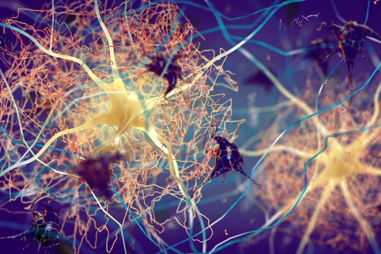 阿尔茨海默病或起源于皮肤、肺部或肠道炎症