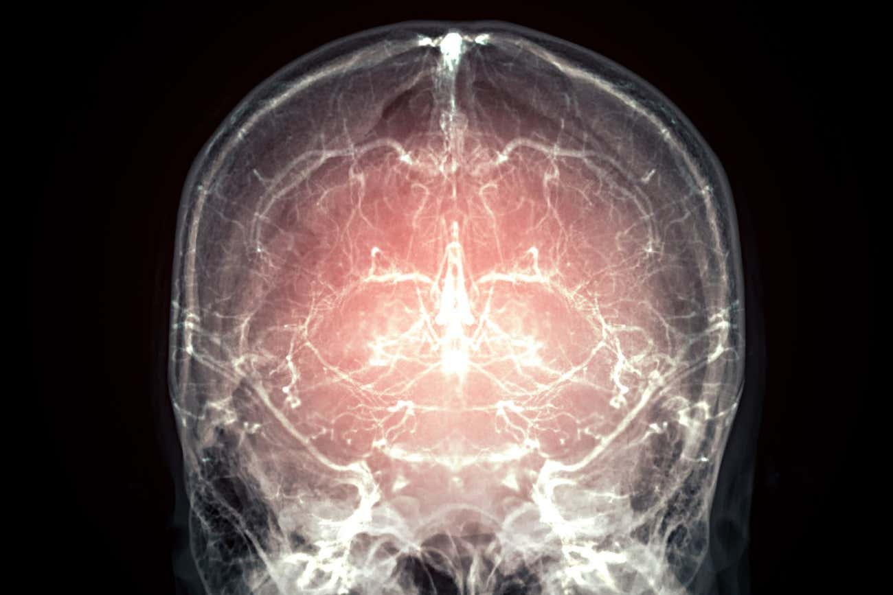 哺乳动物大脑保存技术取得突破，死后复生迎来曙光