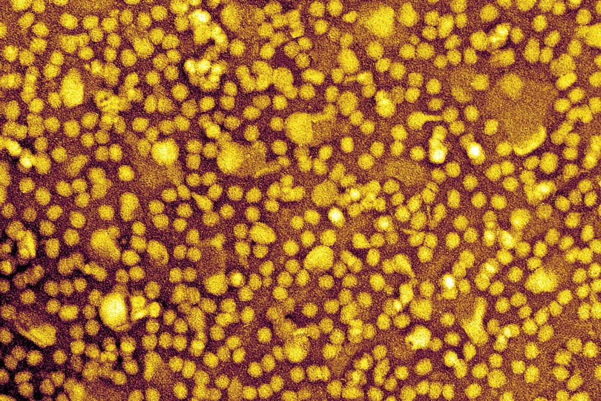 心脏病预防能一劳永逸吗？科学家证明这或许可行。