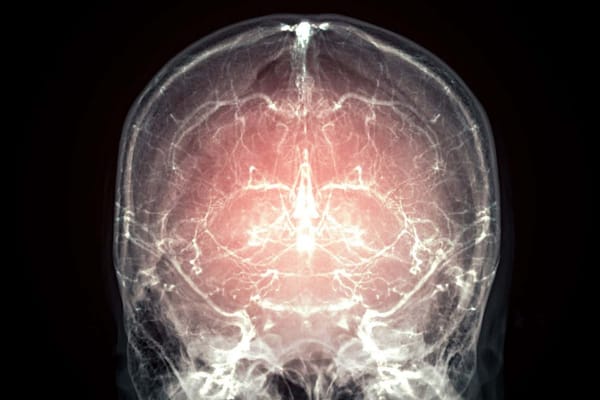 哺乳动物大脑保存技术取得突破，死后复生迎来曙光